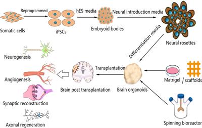 The Application of Brain Organoid Technology in Stroke Research: Challenges and Prospects